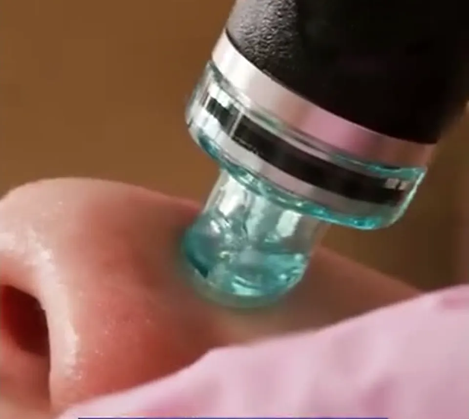 Close view of the HydraFacial tip against skin.