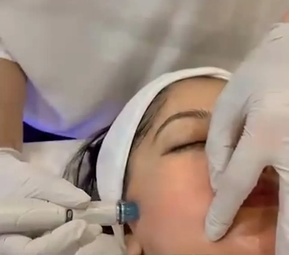 A HydraFacial in progress, gloved hands and a headband.